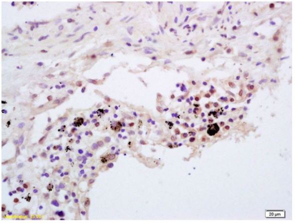 Immunohistochemistry (Formalin/PFA-fixed paraffin-embedded sections) - Anti-TNFAIP3 antibody (AB217706), expandable thumbnail