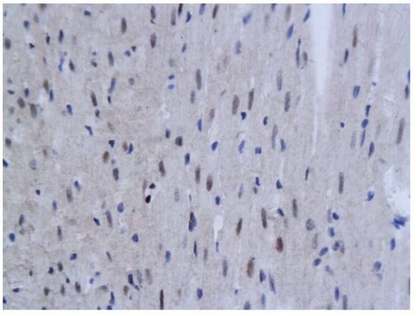Immunohistochemistry (Formalin/PFA-fixed paraffin-embedded sections) - Anti-TNFAIP3 antibody (AB217706), expandable thumbnail