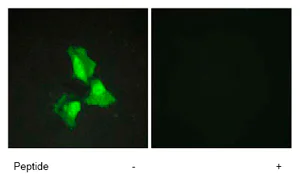 Immunocytochemistry/ Immunofluorescence - Anti-TNFAIP3 antibody (AB74037)