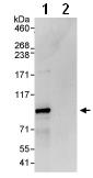 Immunoprecipitation - Anti-TNFAIP3 antibody (AB93868)