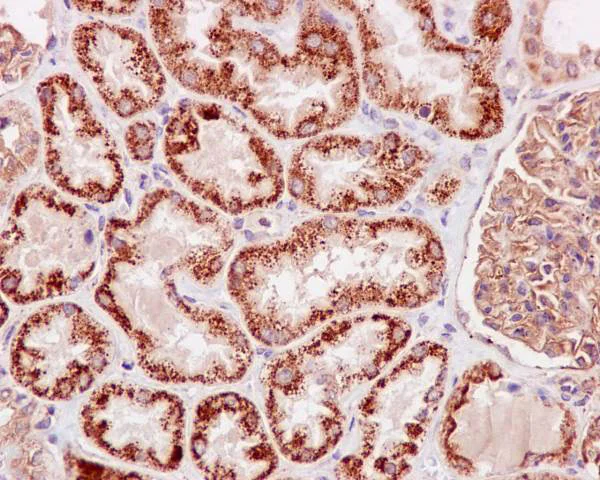 Immunohistochemistry (Formalin/PFA-fixed paraffin-embedded sections) - Anti-TNFAIP3 antibody [EPR2663] - BSA and Azide free (AB227987)