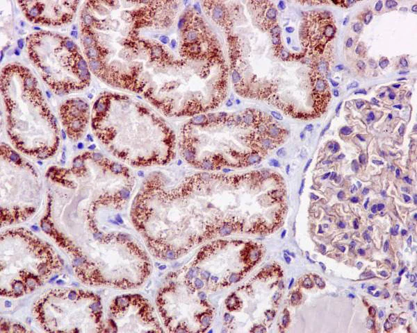 Immunohistochemistry (Formalin/PFA-fixed paraffin-embedded sections) - Anti-TNFAIP3 antibody [EPR2663] - BSA and Azide free (AB227987)