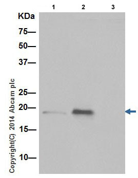 Immunoprecipitation - Anti-TNFAIP8 antibody [EPR10058(3)] (AB195810), expandable thumbnail