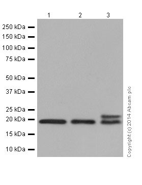 Western blot - Anti-TNFAIP8 antibody [EPR10058(3)] (AB195810), expandable thumbnail