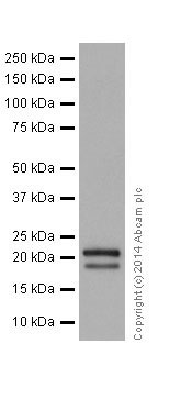 Western blot - Anti-TNFAIP8 antibody [EPR10058(3)] (AB195810), expandable thumbnail