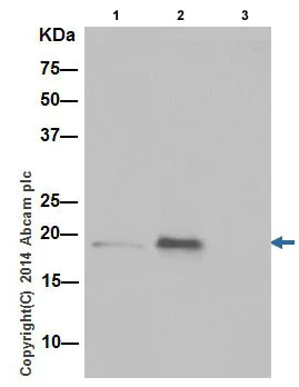 Immunoprecipitation - Anti-TNFAIP8 antibody [EPR10058(3)] - BSA and Azide free (AB251212)