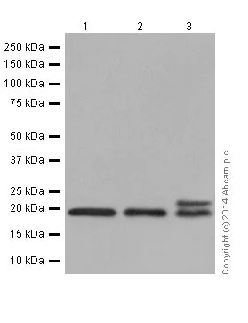 Western blot - Anti-TNFAIP8 antibody [EPR10058(3)] - BSA and Azide free (AB251212)