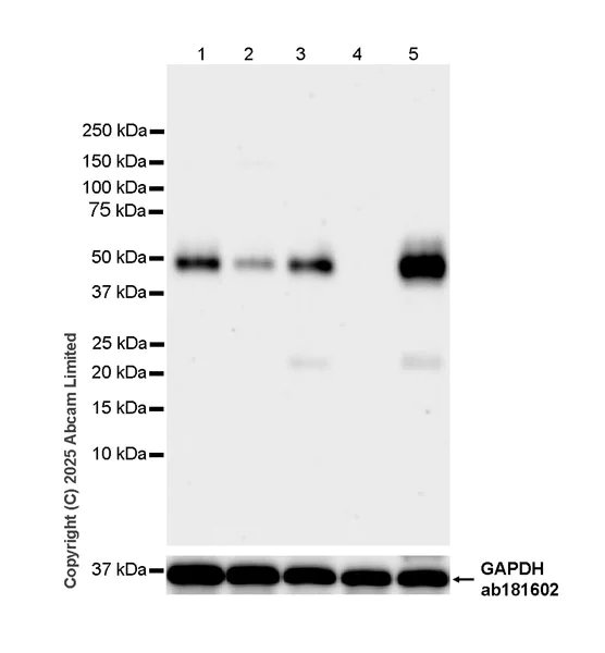 Western blot - Anti-TNFRSF10B antibody [RM2078] (AB323371)