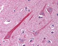 Immunohistochemistry (Formalin/PFA-fixed paraffin-embedded sections) - Anti-TNFRSF14/HVEM antibody (AB115544)