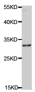 Western blot - Anti-TNFRSF14/HVEM antibody (AB185711), expandable thumbnail