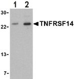 Western blot - Anti-TNFRSF14/HVEM antibody (AB47677)