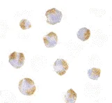Immunocytochemistry - Anti-TNFRSF14/HVEM antibody (AB62462)