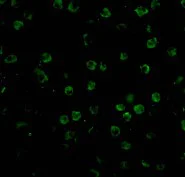 Immunocytochemistry - Anti-TNFRSF14/HVEM antibody (AB62462)