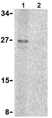 Western blot - Anti-TNFRSF14/HVEM antibody (AB62462)