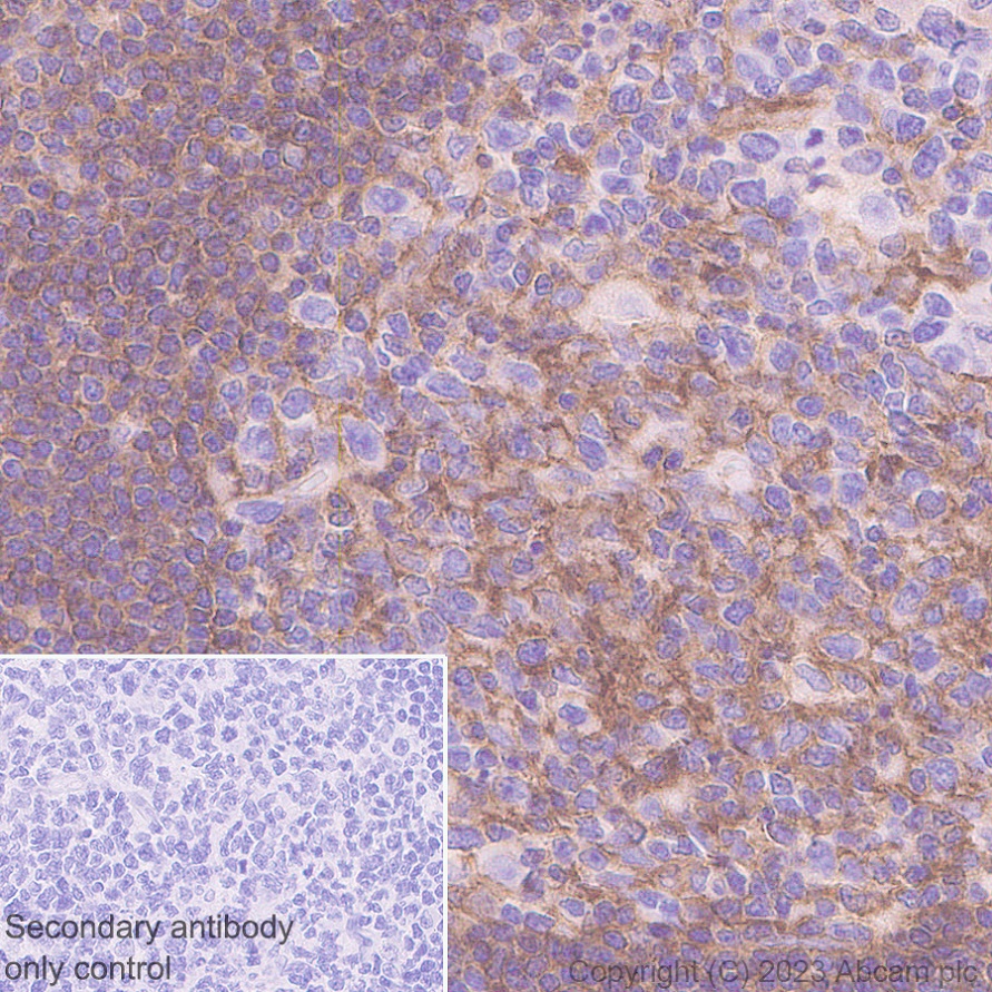 Immunohistochemistry (Formalin/PFA-fixed paraffin-embedded sections) - Anti-TNFRSF14/HVEM antibody [EPR28154-164] (AB314494), expandable thumbnail