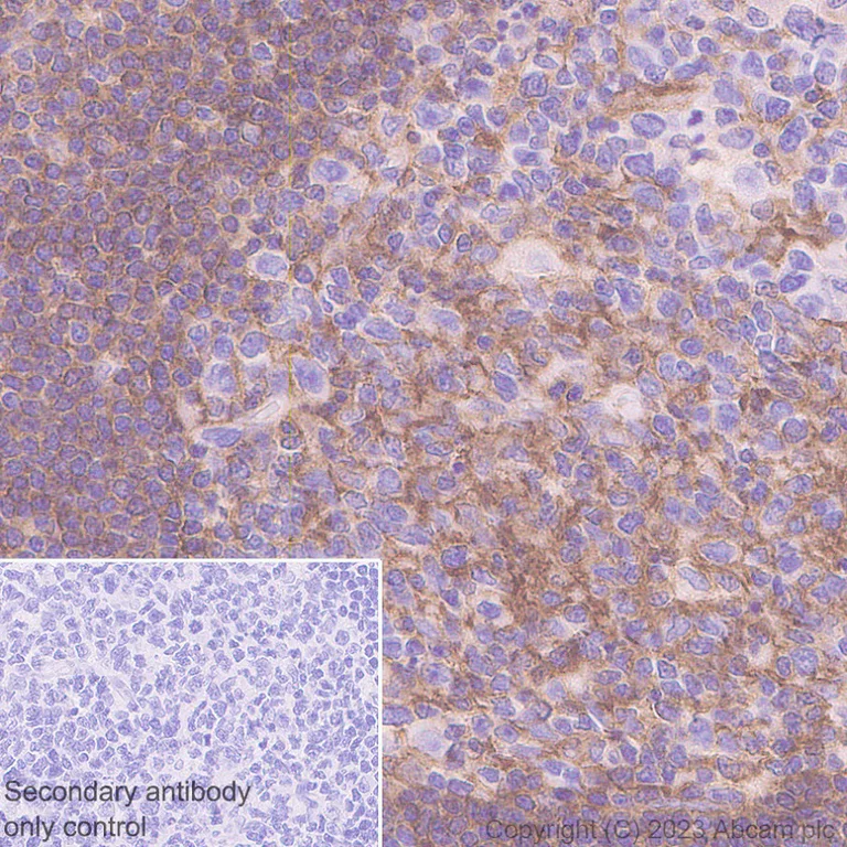 Immunohistochemistry (Formalin/PFA-fixed paraffin-embedded sections) - Anti-TNFRSF14/HVEM antibody [EPR28154-164] (AB314494)