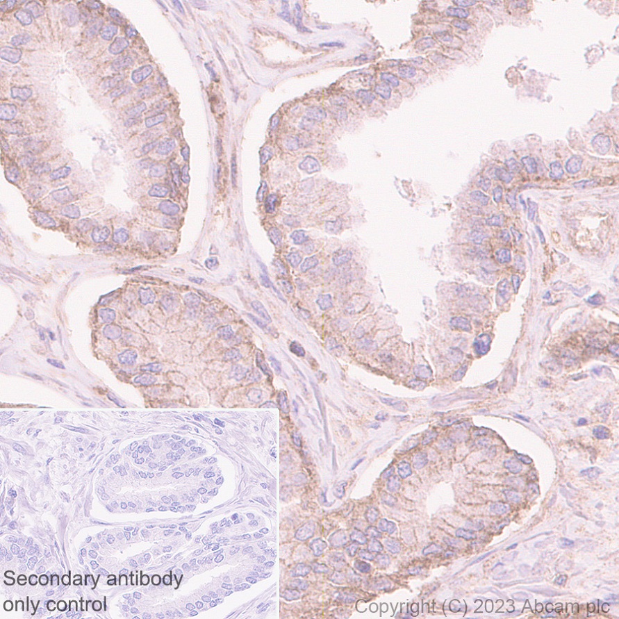 Immunohistochemistry (Formalin/PFA-fixed paraffin-embedded sections) - Anti-TNFRSF14/HVEM antibody [EPR28154-164] (AB314494), expandable thumbnail