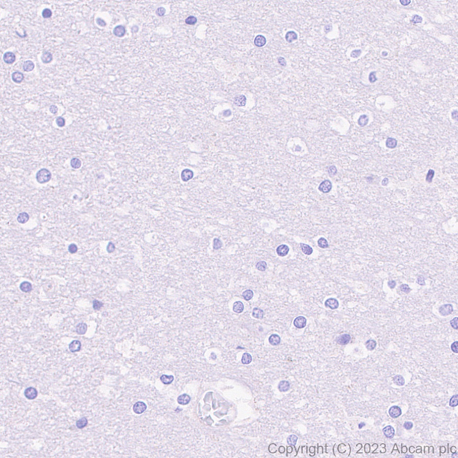 Immunohistochemistry (Formalin/PFA-fixed paraffin-embedded sections) - Anti-TNFRSF14/HVEM antibody [EPR28154-164] (AB314494), expandable thumbnail