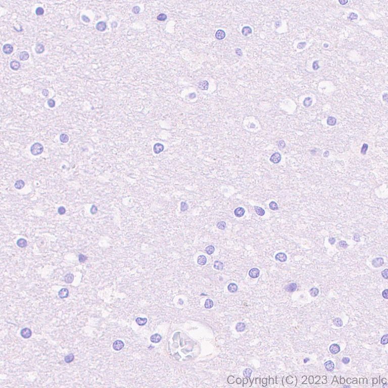 Immunohistochemistry (Formalin/PFA-fixed paraffin-embedded sections) - Anti-TNFRSF14/HVEM antibody [EPR28154-164] (AB314494)