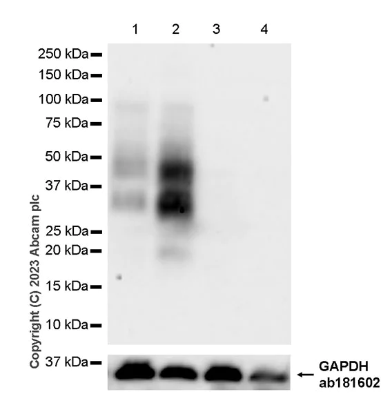 Western blot - Anti-TNFRSF14/HVEM antibody [EPR28154-164] (AB314494)