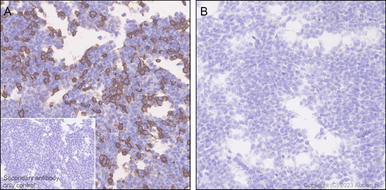 Immunohistochemistry (Formalin/PFA-fixed paraffin-embedded sections) - Anti-TNFRSF14/HVEM antibody [EPR28154-164] - BSA and Azide free (AB314495)