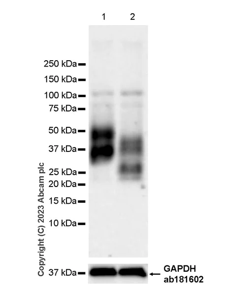 Western blot - Anti-TNFRSF14/HVEM antibody [EPR28154-164] - BSA and Azide free (AB314495)