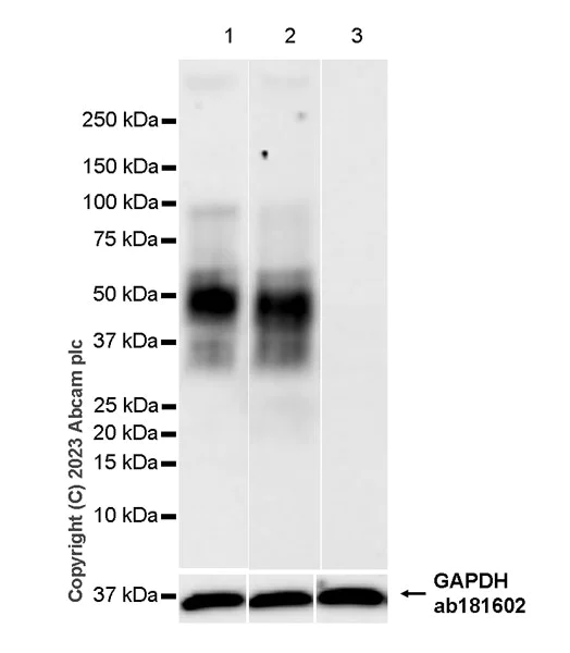 Western blot - Anti-TNFRSF14/HVEM antibody [EPR28154-164] - BSA and Azide free (AB314495)