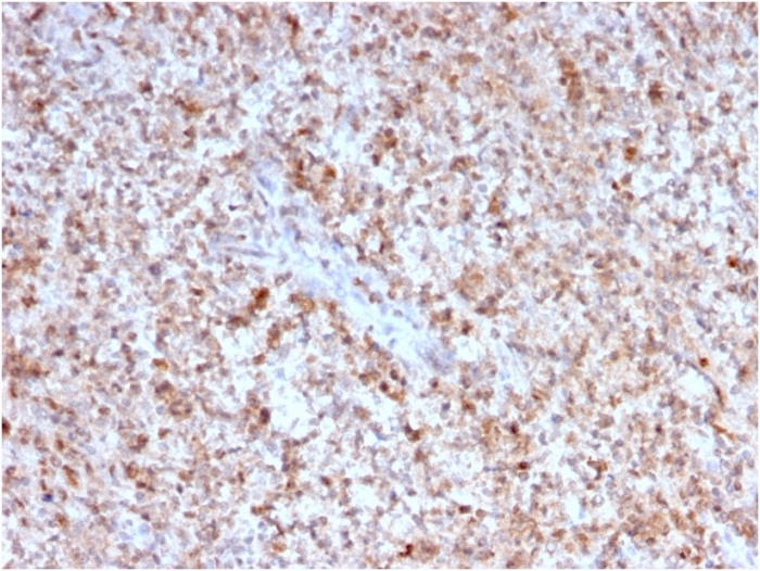 Immunohistochemistry (Formalin/PFA-fixed paraffin-embedded sections) - Anti-TNFSF5 antibody [CD40LG/2763] - BSA and Azide free (AB268270), expandable thumbnail