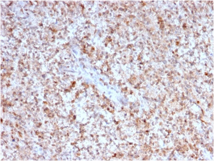 Immunohistochemistry (Formalin/PFA-fixed paraffin-embedded sections) - Anti-TNFSF5 antibody [CD40LG/2763] - BSA and Azide free (AB268270)