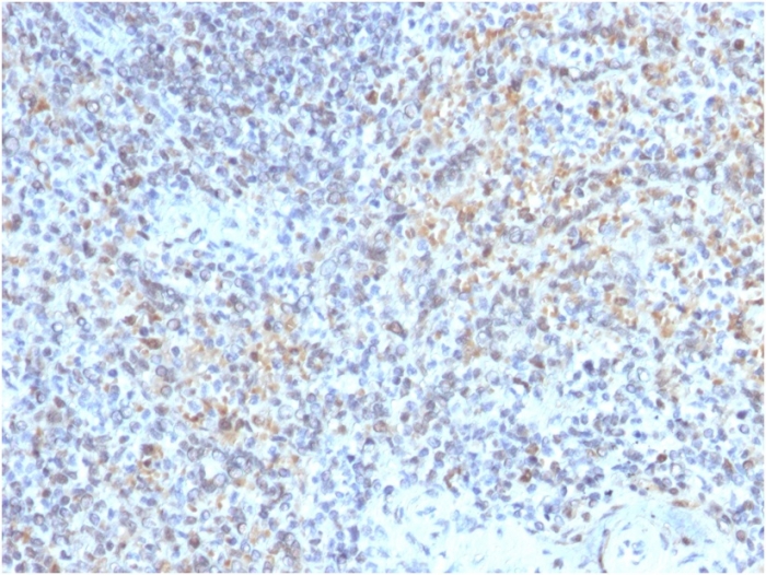 Immunohistochemistry (Formalin/PFA-fixed paraffin-embedded sections) - Anti-TNFSF5 antibody [CD40LG/2763] - BSA and Azide free (AB268270), expandable thumbnail