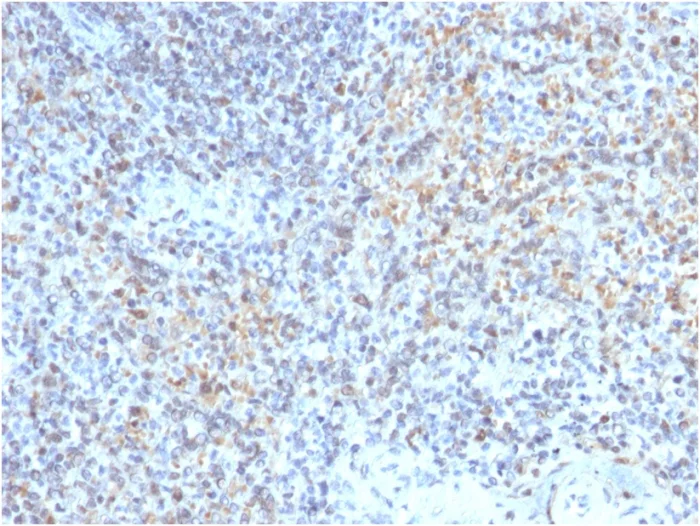 Immunohistochemistry (Formalin/PFA-fixed paraffin-embedded sections) - Anti-TNFSF5 antibody [CD40LG/2763] - BSA and Azide free (AB268270)