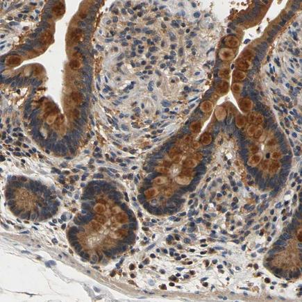 Immunohistochemistry (Formalin/PFA-fixed paraffin-embedded sections) - Anti-TNIK antibody (AB224252)