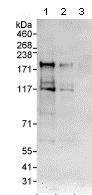 Western blot - Anti-TNIK antibody (AB95887), expandable thumbnail