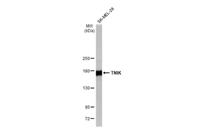 Western blot - Anti-TNIK antibody [HL1751] (AB308194)