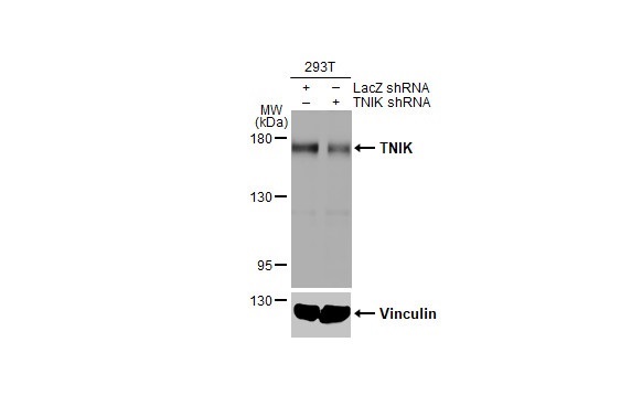 Western blot - Anti-TNIK antibody [HL1751] (AB308194)