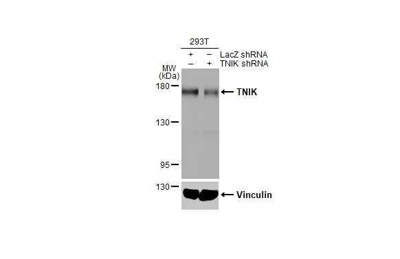 Western blot - Anti-TNIK antibody [HL1751] (AB308194)