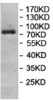 Western blot - Anti-TNIP1 antibody (AB207584)