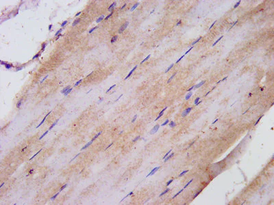 Immunohistochemistry (Formalin/PFA-fixed paraffin-embedded sections) - Anti-TNIP1 antibody (AB236984)