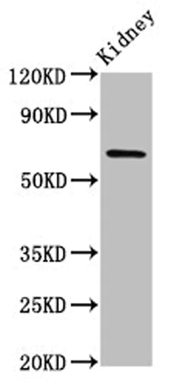 Western blot - Anti-TNIP1 antibody (AB236984)