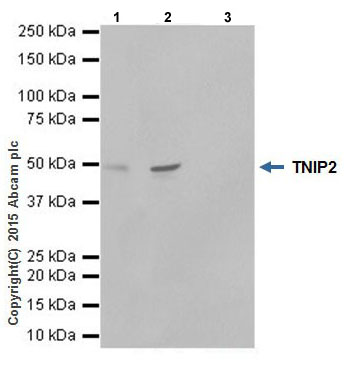 Immunoprecipitation - Anti-TNIP2 antibody [EPR17434] (AB205925), expandable thumbnail