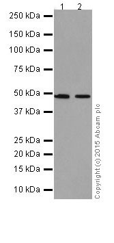 Western blot - Anti-TNIP2 antibody [EPR17434] (AB205925), expandable thumbnail