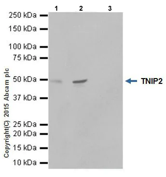 Immunoprecipitation - Anti-TNIP2 antibody [EPR17434] - BSA and Azide free (AB232561)