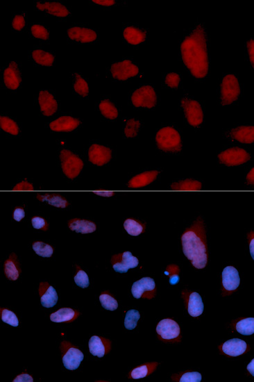 Immunocytochemistry/ Immunofluorescence - Anti-TNNC1 antibody (AB180732)