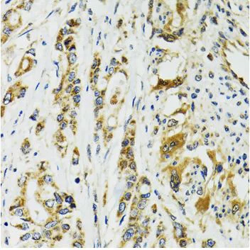 Immunohistochemistry (Formalin/PFA-fixed paraffin-embedded sections) - Anti-TNNC1 antibody (AB180732)