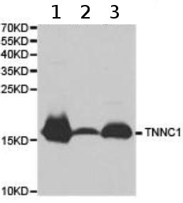 Western blot - Anti-TNNC1 antibody (AB180732)