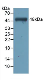Western blot - Anti-TNNC1 antibody [C5] (AB239578)