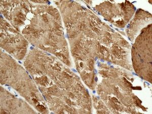 Immunohistochemistry (Formalin/PFA-fixed paraffin-embedded sections) - Anti-TNNC1 antibody [EPR9692(B)] (AB137130), expandable thumbnail