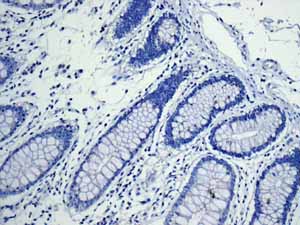 Immunohistochemistry (Formalin/PFA-fixed paraffin-embedded sections) - Anti-TNNC1 antibody [EPR9692(B)] (ab137130), expandable thumbnail