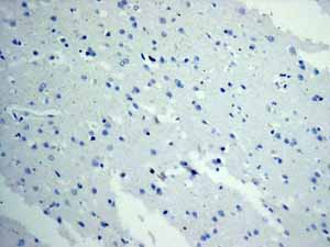 Immunohistochemistry (Formalin/PFA-fixed paraffin-embedded sections) - Anti-TNNC1 antibody [EPR9692(B)] (AB137130), expandable thumbnail