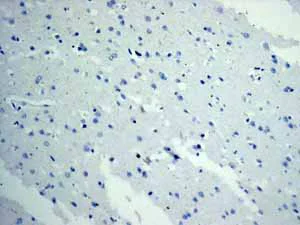 Immunohistochemistry (Formalin/PFA-fixed paraffin-embedded sections) - Anti-TNNC1 antibody [EPR9692(B)] (AB137130)